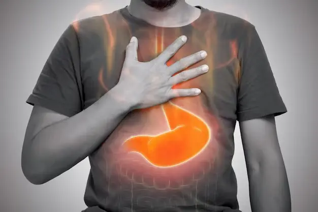 Coconut Oil for Acid Reflux: Does It Help or Make It Worse? 49 Acid Reflux vs. GERD: What's the Difference?